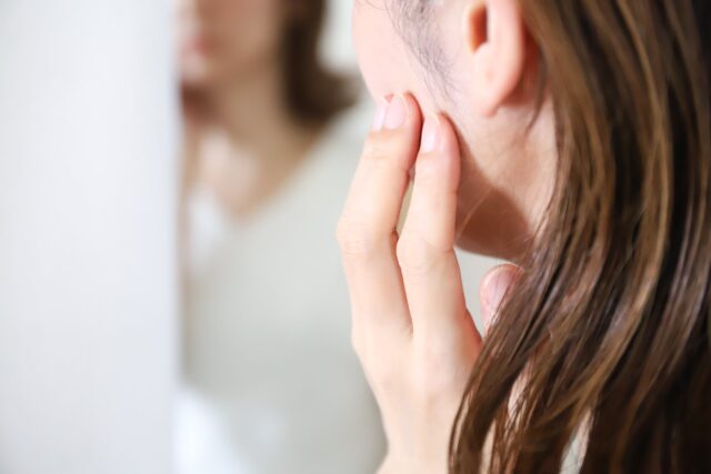 皮膚科医がシミの種類について解説