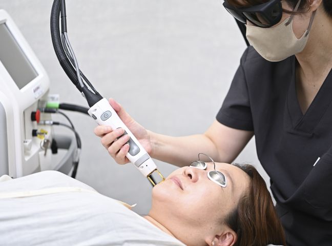 レーザーフェイシャル