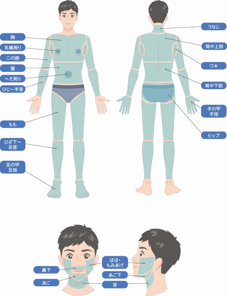 男性の脱毛可能なパーツ