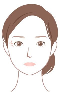ADMのイラスト