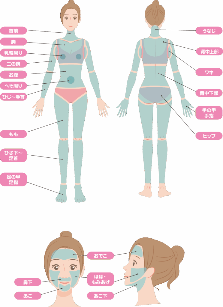 女性の脱毛可能なパーツ