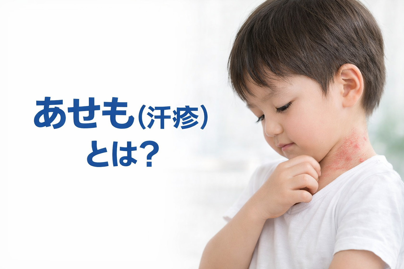 あせも（汗疹）とは？　原因と対処法を皮膚科医が解説