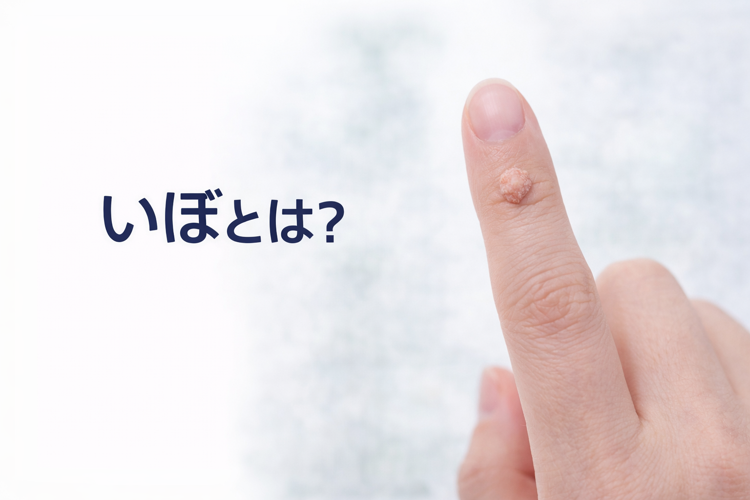 いぼとは？　原因と治療について皮膚科医が解説