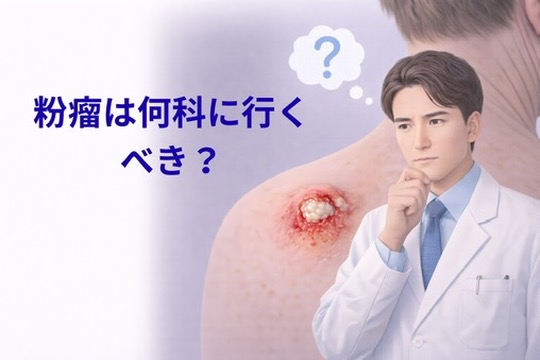 【札幌の皮膚科医が解説】粉瘤は何科に行くべき？皮膚科でいいのか