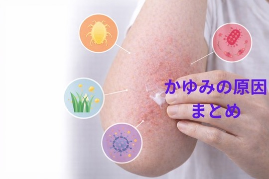 かゆみの原因まとめ | 皮膚のかゆみで考えられる原因を皮膚科医が解説