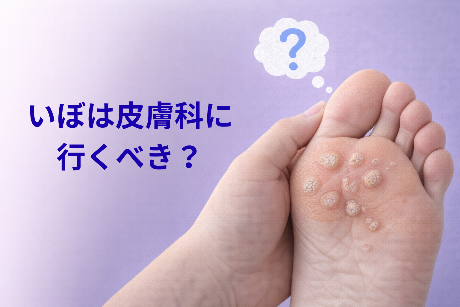 いぼは皮膚科に行くべき？ 放置していいのか皮膚科医が解説