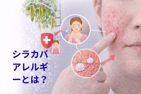 シラカバ花粉によるアレルギーとは？ 北海道で多い症状と対策を皮膚科医が解説